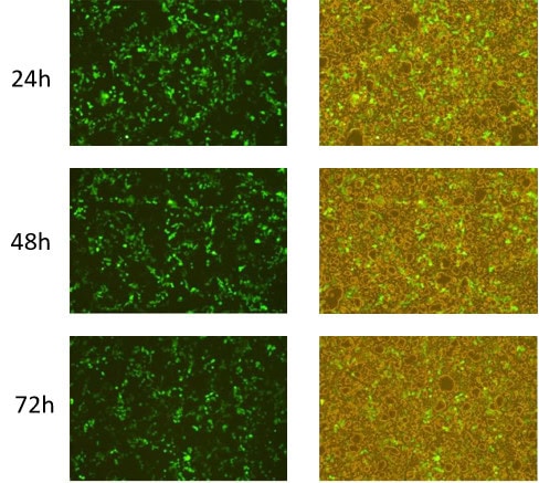 BP-13-50 CircRNA Synthesis Kit: Figure 2 eGFP expression in 293T cells transfected with circRNA