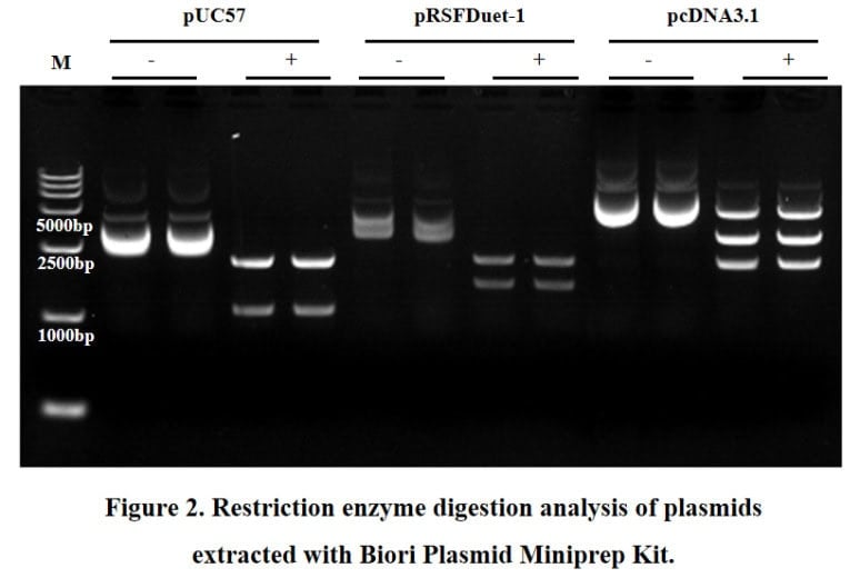 BR2D101 Plasmid Miniprep Kit: Quality verification results of extracted plasmid
