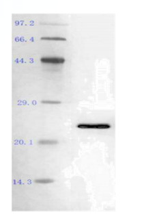 GMP-BP-E03 Pyrophosphatase, Inorganic GMP-grade: Figure 1 SDS-PAGE result of Pyrophosphatase, Inorganic.