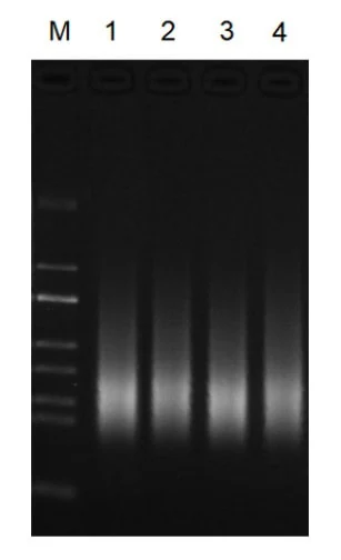 Agarose gel of BR3N602 fragmentation products from swab, sputum, BAL and blood DNA showing matched size profiles